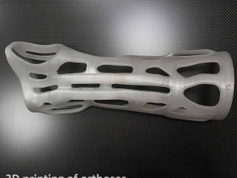3D printing of FDM orthoses with flexible materials