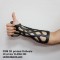 3D printing of orthoses on a 3D printer KLEMA